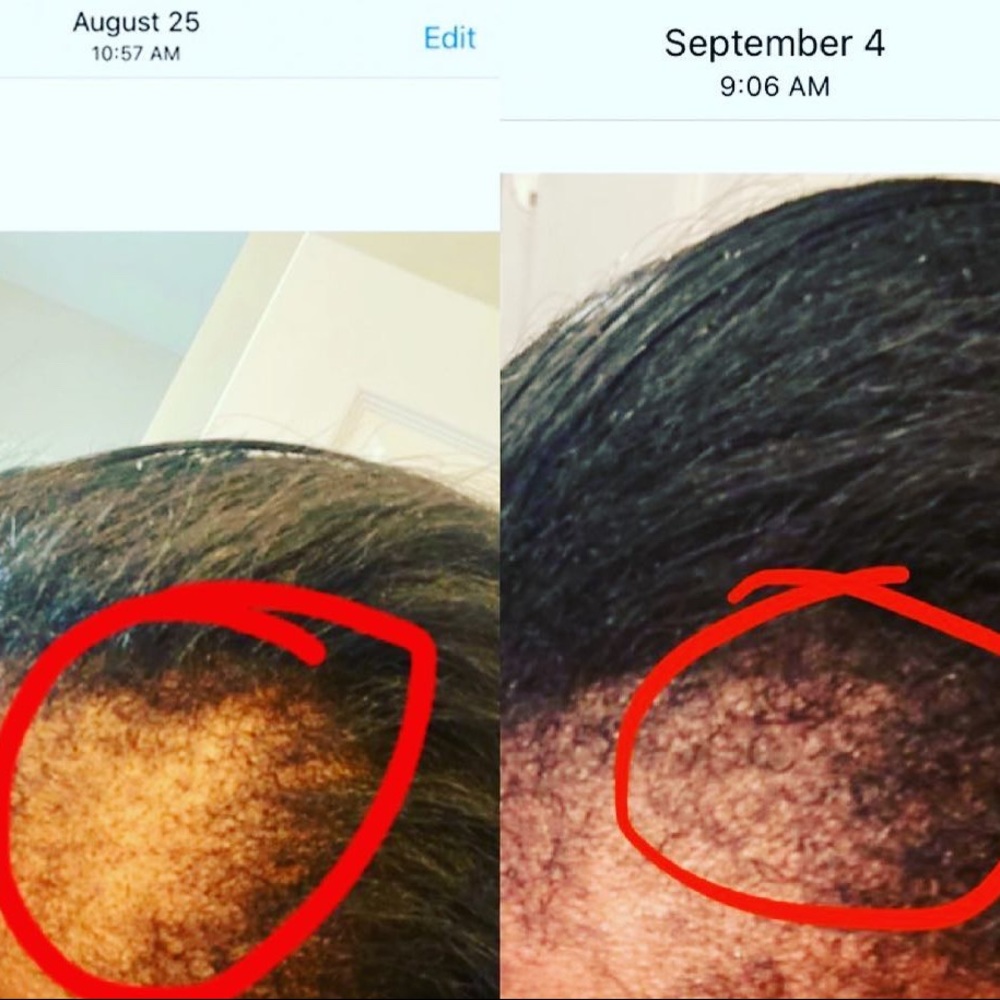 Organic hair growth kit